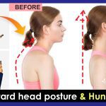 Can Forward Head Posture Be Corrected? A Complete Guide